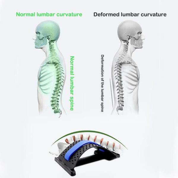 Back Stretcher