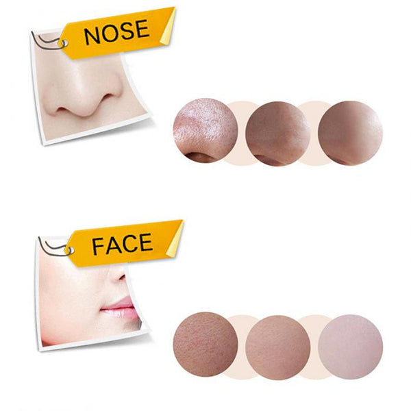 Black Head Remover (Free Shipping)